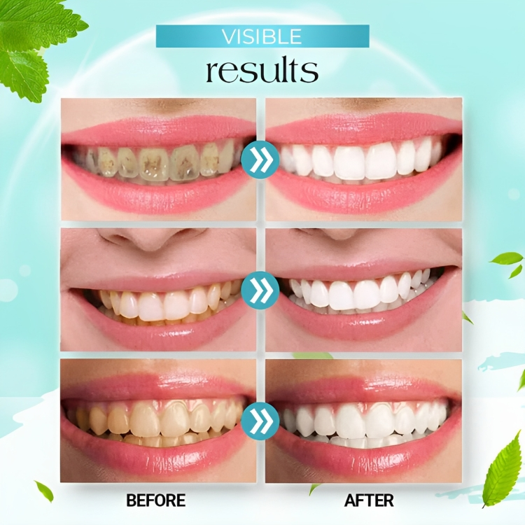 Teeth™ Whitening Foam 60ML