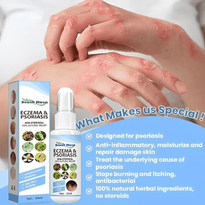 Herbal Psoriasis Relief Spray 🔥 Buy 1 Get 1 Free 🔥