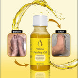 YELLOW®- PEELING OIL FOR DARK SKIN<br>  ⭐️⭐️⭐️⭐️⭐️4.7/5 (12,600+ REVIEW)</br>