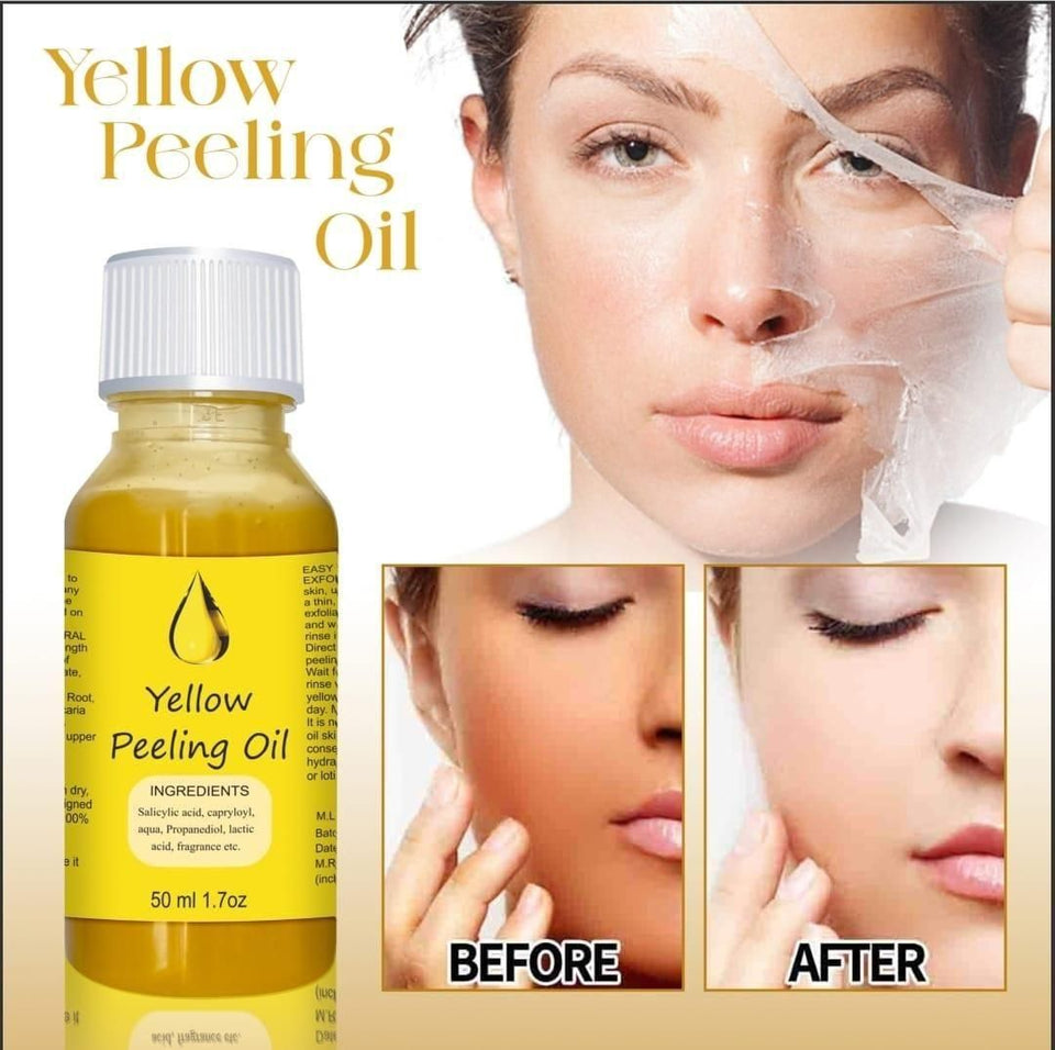 YELLOW®- PEELING OIL FOR DARK SKIN<br>  ⭐️⭐️⭐️⭐️⭐️4.7/5 (12,600+ REVIEW)</br>