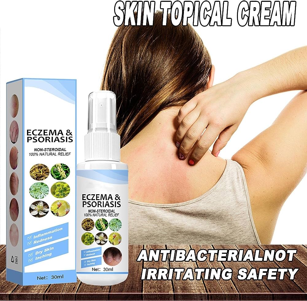 Herbal Psoriasis Skin Care Relief Spray🌿 – INDIA BAZAARS