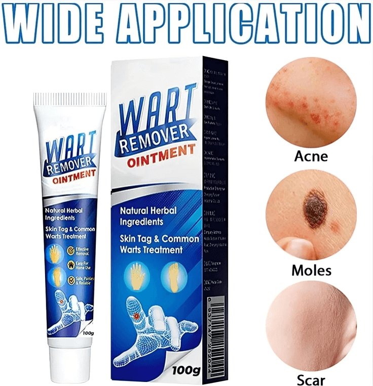 Wart Remover Ointment for All Skin Types (Pack of 1)