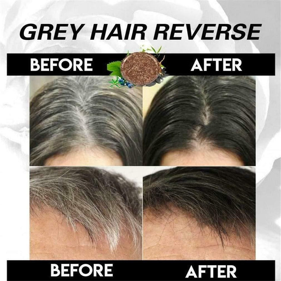 Organic Grey Hair Remover Shampoo Bar 🔥 Buy 1 Get 1 Free 🔥